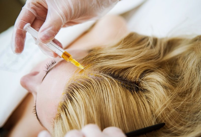 Hair mesotherapy