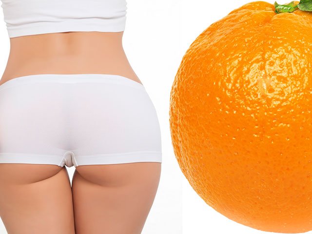 Methods for getting rid of cellulite Methods for getting rid of cellulite