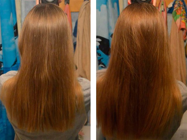 Photos before and after regular use of almond oil