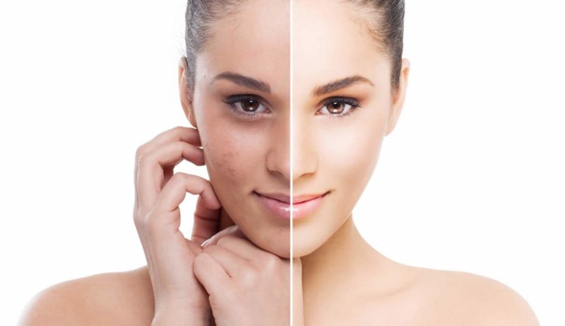 The result of whitening strawberry masks Whitening strawberry masks