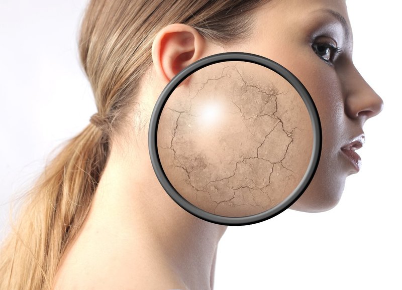 Skin peeling Skin peeling