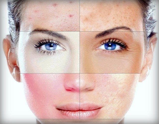 Mask for different skin types
