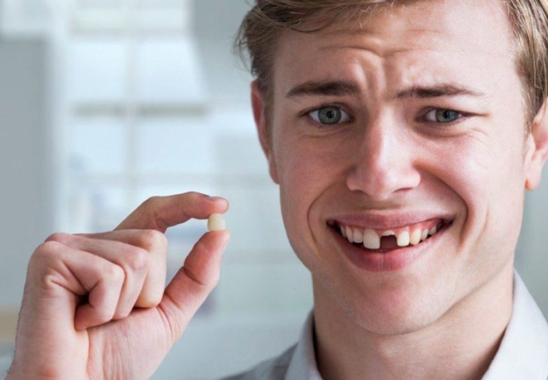 Tooth fell out in a dream