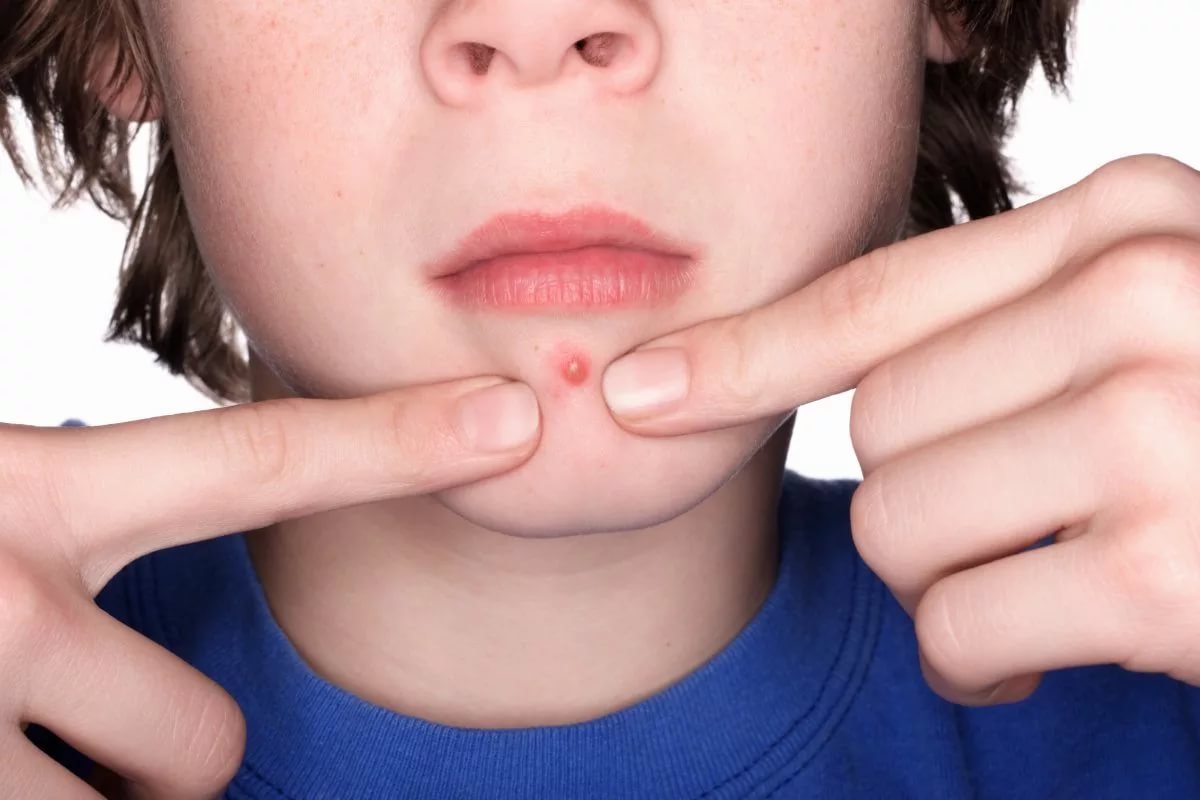 A conspiracy on a boil to a child