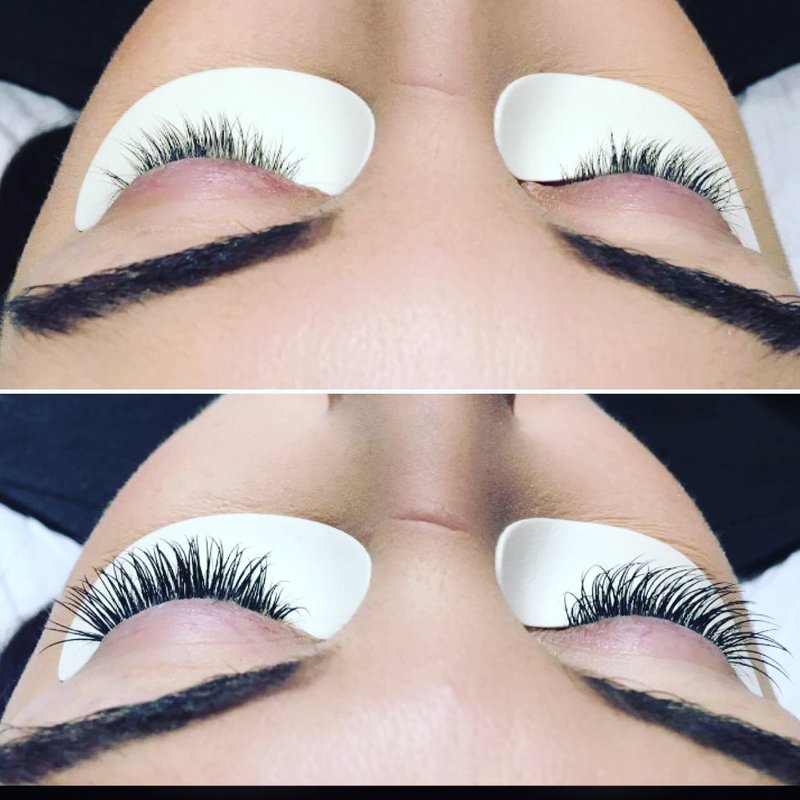 Correction procedure