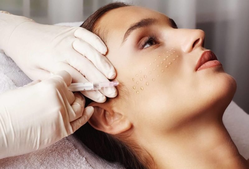 Papules on the face after biorevitalization Papules on the face after biorevitalization