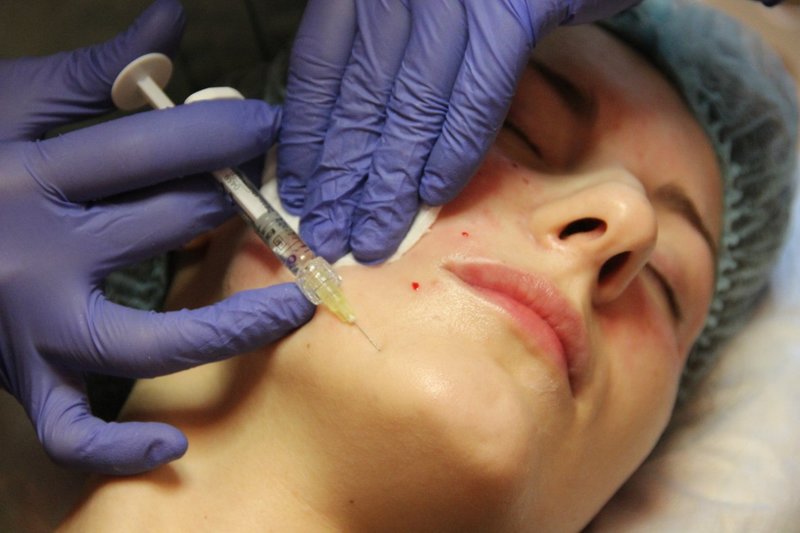 Lower face treatment