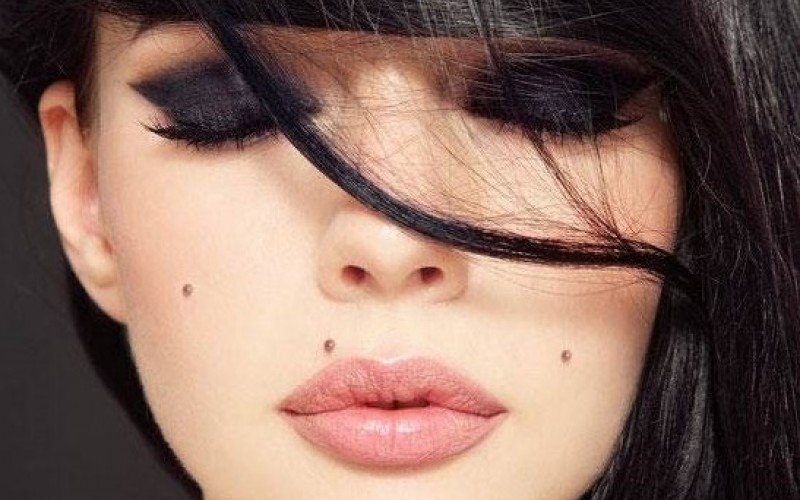 Girl with moles on her face Girl with moles on her face