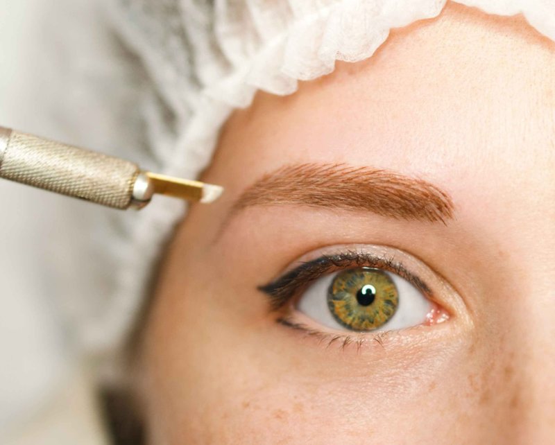 Contraindications to eyebrow tattooing Contraindications to eyebrow tattooing