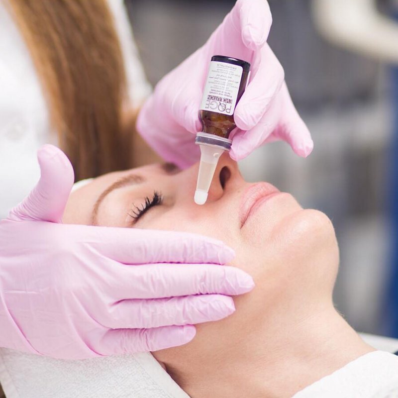 Applying PQ AGE Peeling Applying PQ AGE Peeling