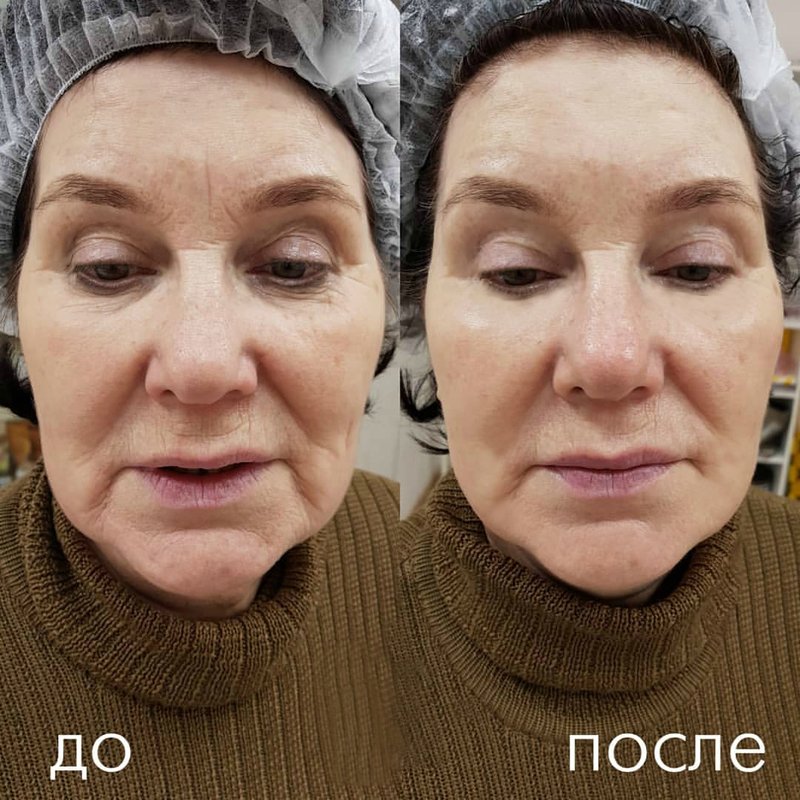 Hardware Lifting Efficiency Hardware Lifting Efficiency