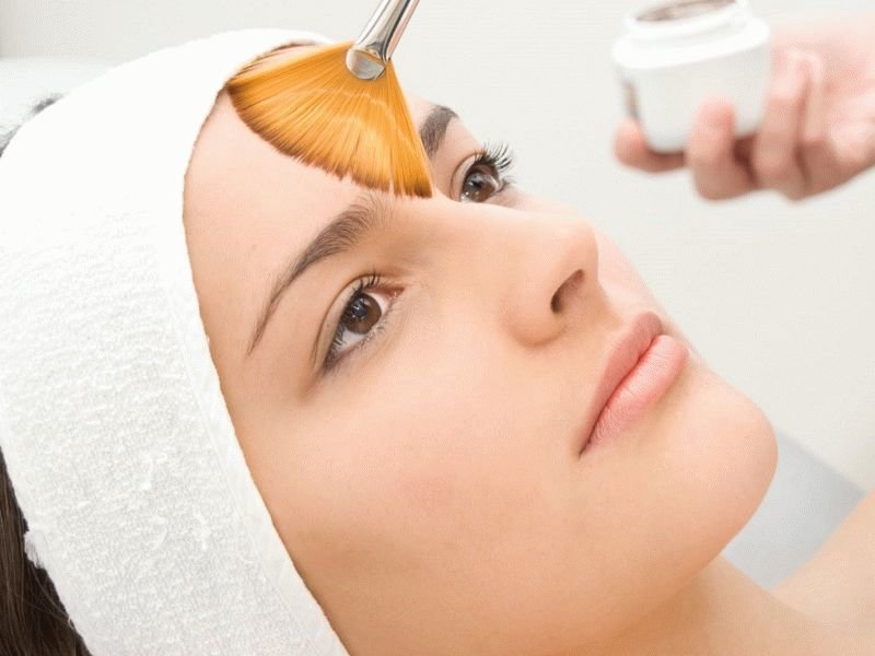 Peeling before biorevitalization