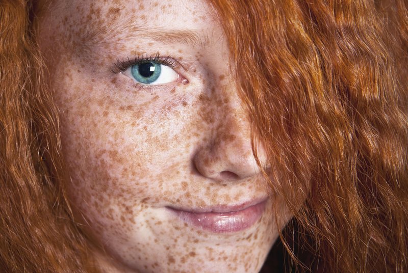 Girl with freckles on her face. Girl with freckles on her face.