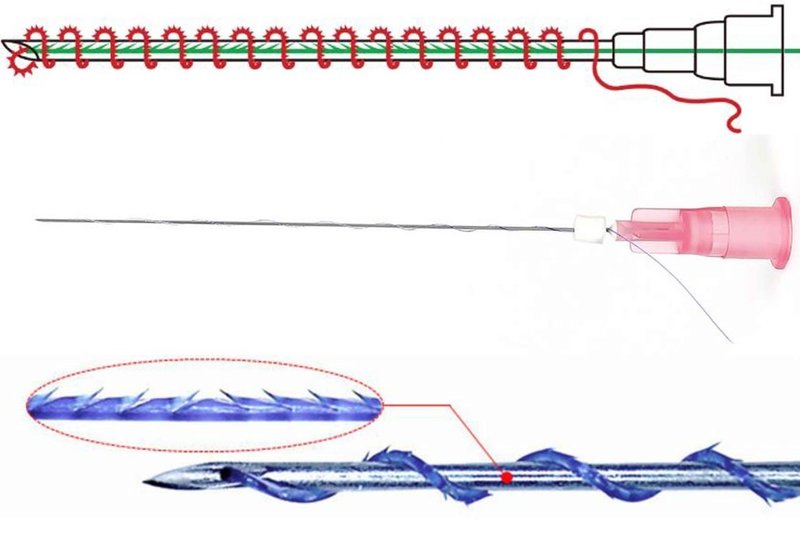 Types of Maisonettes