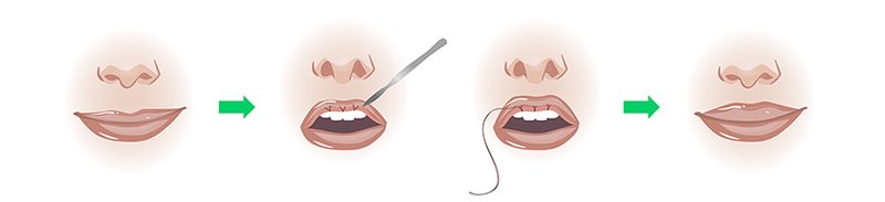 VY plastic VY plastic