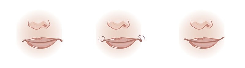 Corner lift Corner lift