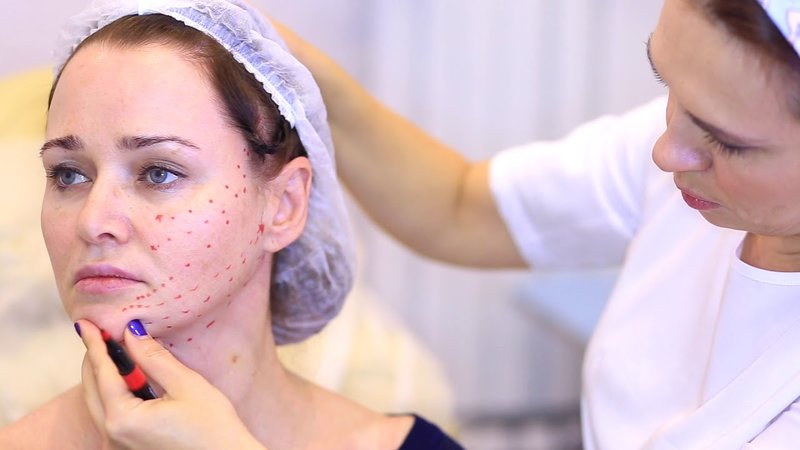 Pros and Cons of Cog Threads