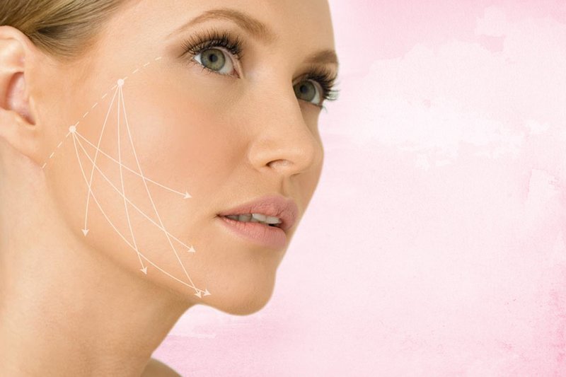 The main advantages of SMAS lifting The main advantages of SMAS lifting