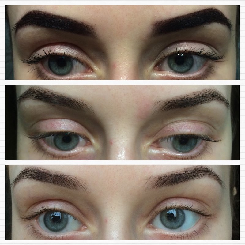 Adjusted eyebrows by hairline after unsuccessful first tattoo Adjusted eyebrows after a failed first tattoo