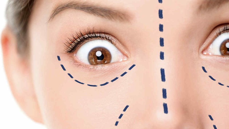 Indications and contraindications for the introduction of mesothreads