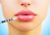 How to care for lips after an increase in hyaluronic acid? Lip augmentation with hyaluronic acid