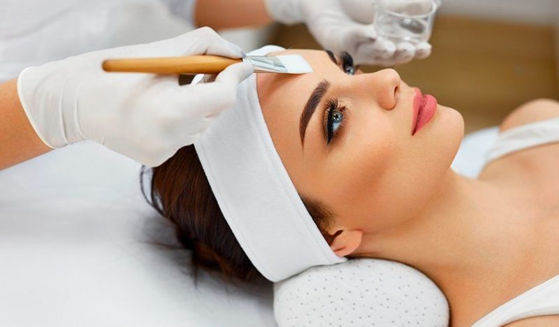 Dry cleaning Acid application