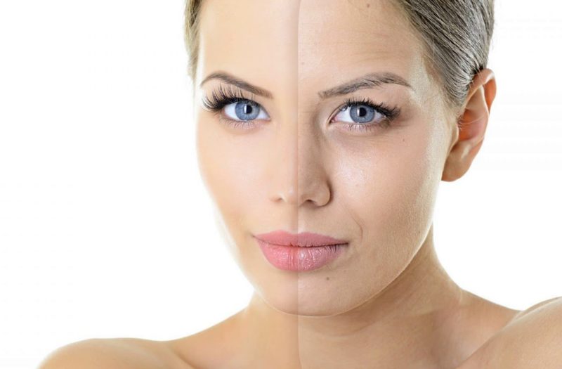 Facial skin restoration after cleansing Skin restoration after cleansing