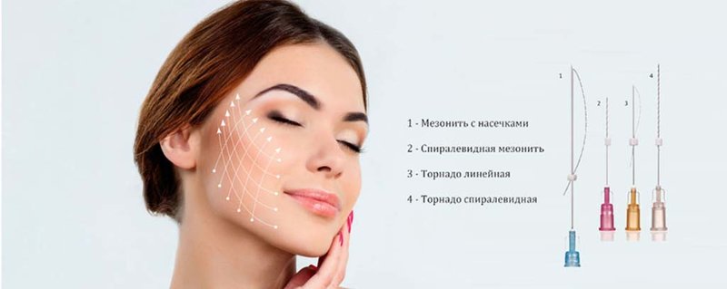 Classification of mesothreads Classification of mesothreads