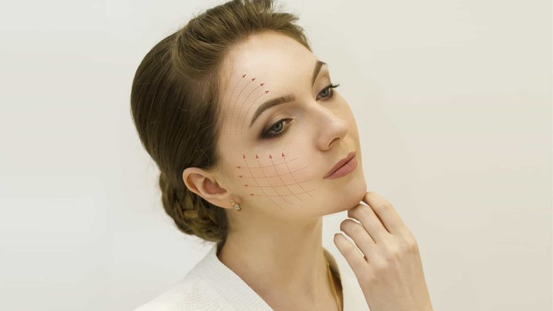 What is the expected effect of a facelift with threads? What is the expected effect of a facelift with threads?