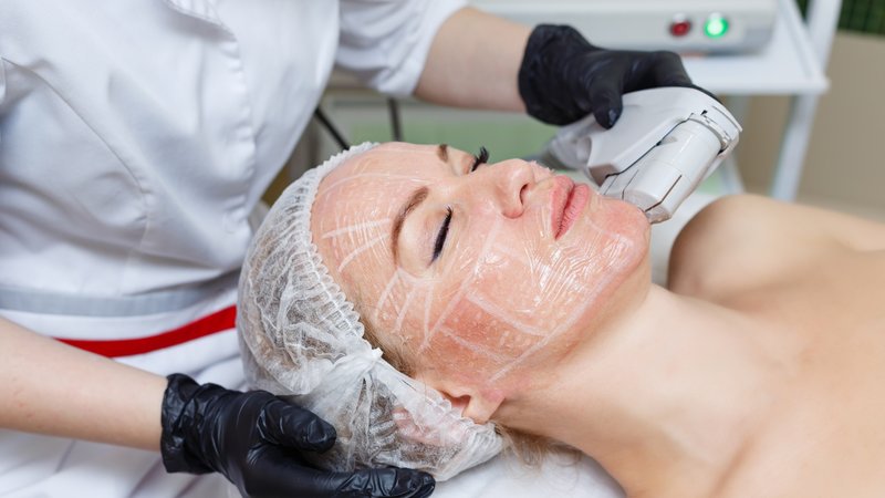 Smas lifting procedure Smas lifting procedure